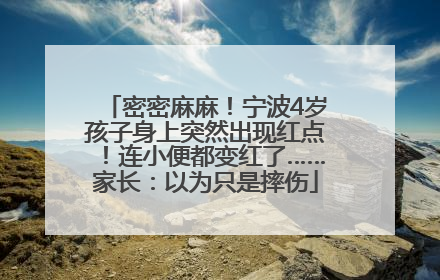密密麻麻！宁波4岁孩子身上突然出现红点！连小便都变红了……家长：以为只是摔伤
